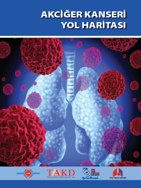 Akciğer Kanseri Yol Haritası Çalışması